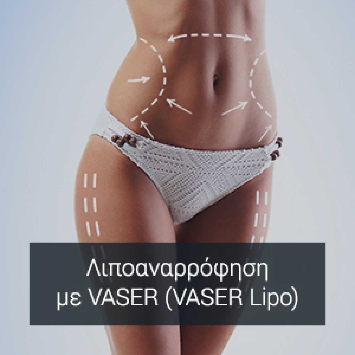 &Lambda;&iota;&pi;&omicron;&alpha;&nu;&alpha;&rho;&rho;ό&phi;&eta;&sigma;&eta; &mu;&epsilon; VASER ( VASER Lipo )